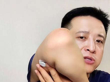 微泰二代怎样校准更准确 #微泰动泰 #微泰二代