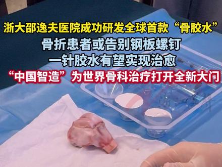 全球首款“骨胶水”来了! 浙大邵逸夫医院团队将北宋“养蛎固基”的智慧转化为黑科技!他们研发的“骨02”骨胶水,能在血液环境中2-3分钟黏合碎骨,6个月自然吸收,还不用二次手术。150多例临床验证有效,最小切口仅2-3厘米,未来还能用于灾害急救,中国智造正改写骨科治疗史!#骨胶水 #骨科治疗 #全球首款“骨胶水”来了