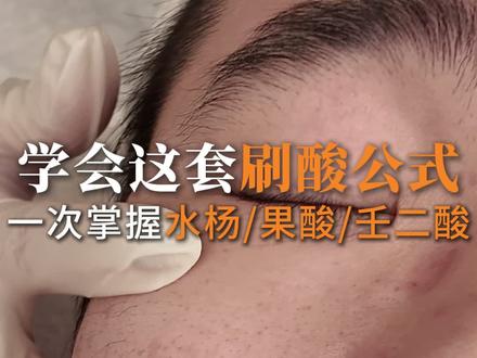 学会这套刷酸公式,一次掌握水杨/果酸/壬二酸
#艾肤学苑 #刷酸培训 #水杨酸培训 #刷酸课程 #壬二酸