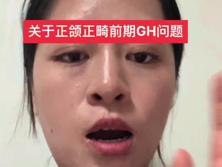 #正颌 #正畸 #地包天 关于正颌正畸前GH问题@DOU+小助手