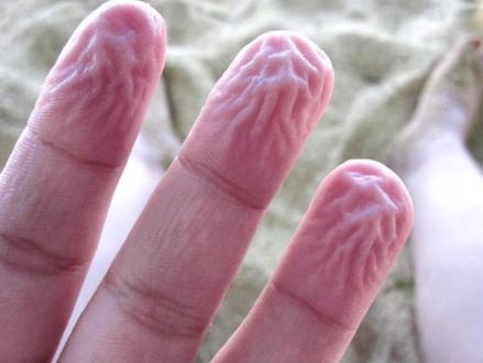 手泡水以后为什么会起皱?#科普 @抖音博士团 #2023科普时刻