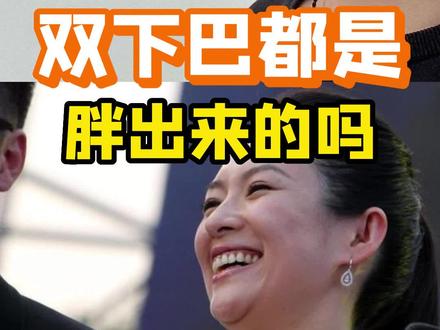 双下巴都是胖出来的吗?为什么有的人明明很瘦也有双下巴#双下巴 #隆颌 #注射美容 #吸脂 #科学变美 #山西