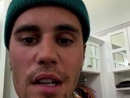 😭贾斯汀比伯患有亨特氏综合征(面瘫)。
病情很严重,导致自己右边脸出现面瘫,右眼无法眨动,右脸也不能抽动。比伯向大家详细解释了这种病。他表示尽管自己很努力让自己好起来,但无奈病情在加重,并根据医生的要求,不得不推迟接下来的巡演,他对此感到很难过,自己需要好好休息,然后好起来。
一定要早日康复。