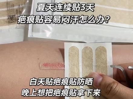 天太热,想白天贴疤痕贴防晒,晚上拿下疤痕贴,但是又不想频繁的更换减张贴,减张贴不拿下来也想擦疤痕凝胶,我们可以试试这样贴~
#疤痕#减张贴#疤痕贴#疤痕护理#术后护理