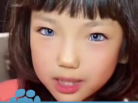 女孩基因突变出生几个月眼睛变蓝色,“虽和别人不一样,但超爱自己的蓝眼睛”#大象主播说