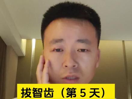 拔智齿-第 5 天:停止痛药了,但还是肿且隐隐作痛! #拔智齿 #智齿 #拔智齿后的日子 #belike精神状态 #智齿疼
