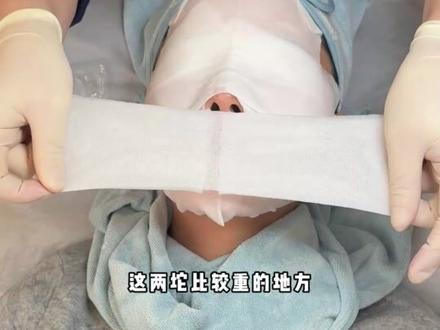 一期合集视频带你看完,黑头、脏毛孔、敏感泛红如何居家处理~#护肤 #闭口粉刺 #油痘肌