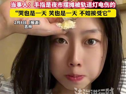 00后女生手指被电伤“借”肉移植,康复过程手指长出“饺子”(杉)