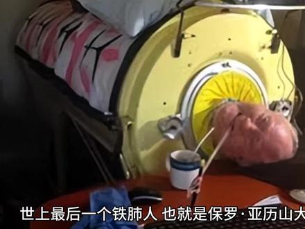 世上最后一个铁肺人去世了。铁肺时代的结束给医学有何影响?#世上最后的铁肺人离世 #铁肺人 #保罗亚历山大 #呼吸机