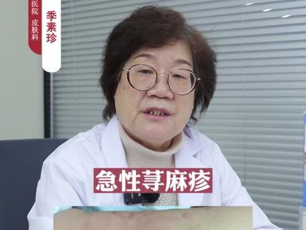 身上突然出现风团,特别痒,别抓,可以这样处理#荨麻疹 #皮肤 #科普