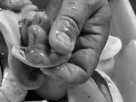 大叔开蟒蛇蛋,开出2条没长眼睛的畸形蛇,其中一条胎死蛋中#蟒蛇#蛇蛋#孵化#蛋蛋#基因缺陷#畸形#眼睛#宠物