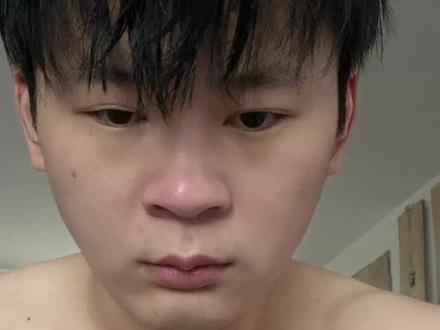 一分半钟了解焦虑抑郁躯体化#躯体化#焦虑 #抑郁