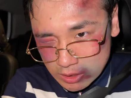 脱缰凯被删除的视频