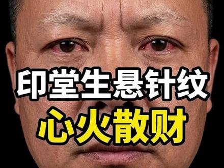 印堂生悬针,心火散财 #知识创作人 #传统文化 #面相识人