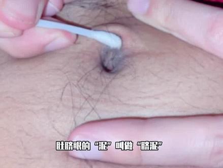 肚脐眼里的“泥”是啥?到底能不能抠?显微镜放大1000倍真酸爽