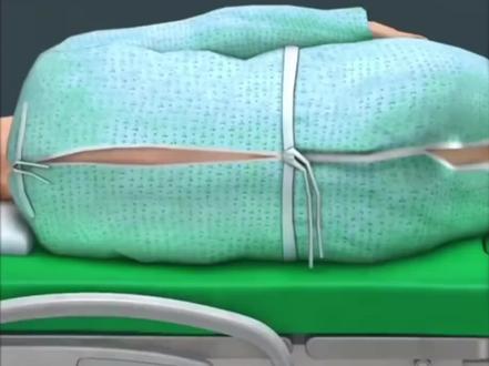 肠镜检查前清肠攻略:喝泻药的正确姿势 #肠镜检查 #肠镜检查前的准备工作 #衡阳肛肠科医生李兵剑