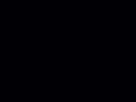 #精神病#心理疾病
下列是正常完全列举
智力发育障碍(智力残疾)
自闭症谱系障碍(ASD)
注意缺陷/多动障碍(ADHD)
特定学习障碍(阅读障碍、数学障碍等)
抽动障碍(如妥瑞氏综合征)
精神分裂症
偏执型、瓦解型、紧张型等亚型
分裂情感性障碍
短暂精神病性障碍
妄想性障碍(如被害妄想、嫉妒妄想)
物质/药物诱发精神病性障碍
双相Ⅰ型障碍(伴躁狂发作)
双相Ⅱ型障碍(伴轻躁狂发作)
环性心境障碍
重性抑郁障碍(MDD)
持续性抑郁障碍(心境恶劣)
经前期烦躁障碍(PMDD)
破坏性心境失调障碍(儿童青少年
广泛性焦虑障碍(GAD)
惊恐障碍(急性焦虑发作)
社交焦虑障碍(社交恐惧症)
特定恐惧症(如幽闭恐惧、动物恐惧)
分离焦虑障碍
强迫症(OCD)
躯体变形障碍(BDD)
囤积障碍
拔毛癖(拔毛障碍)
抓痕障碍(皮肤搔抓障碍)
创伤后应激障碍(PTSD)
急性应激障碍
适应障碍
反应性依恋障碍
分离性身份障碍(多重人格障碍)
分离性遗忘症
人格解体/现实解体障碍
躯体症状障碍
疾病焦虑障碍(疑病症)
转换障碍(功能性神经症状障碍)
神经性厌食症
神经性贪食症
暴食障碍
异食癖
失眠障碍
嗜睡症
梦魇障碍
不宁腿综合征
性欲减退障碍
勃起功能障碍
女性性高潮障碍
酒精使用障碍
阿片类药物使用障碍
尼古丁使用障碍
赌博障碍(行为成瘾)
偏执型人格障碍
边缘型人格障碍(BPD)
反社会型人格障碍
强迫型人格障碍
表演型人格障碍
自残行为(非自杀性自伤)
性别烦躁(性别认同障碍)
说明
术语来源:以上名称基于DSM-5和ICD-11的临床定义,部分疾病