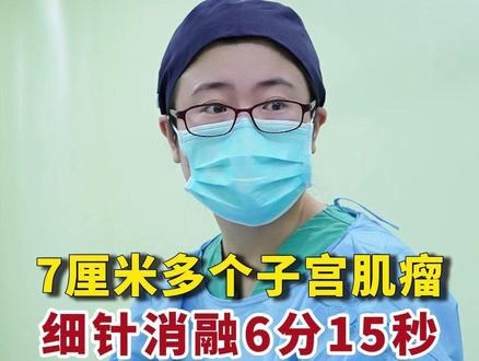 7厘米的子宫肌瘤细针消融6分15秒,还有2个4厘米和1个3厘米一起处理#子宫肌瘤 #子宫 #消融 #肌瘤 #微创