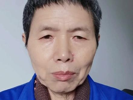 粗晶防止措施。合金结构钢八级为细晶粒,一级为大晶粒。铝合金晶粒度定义与其相反。#模具设计与制造 #失效分析 #deform模拟 #晶粒度 #锻件毛坯