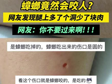 蟑螂竟然会咬人!网友:你不要过来啊! #小强 #曱甴 #广东蟑螂 #万万没想到 #蟑螂咬人 @抖音热点宝 @DOU+上热门 @抖音媒体内容优推官 @抖音小助手 @DOU+小助手