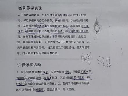不认字是到不了美国的,大概率在中国呆着