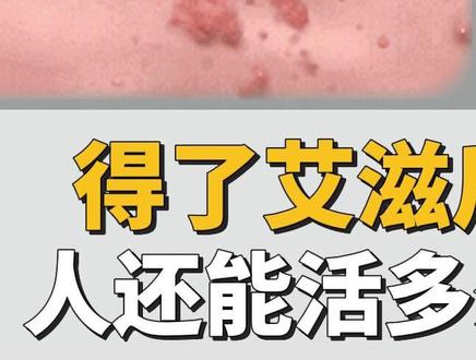 得了艾滋后人还能活多久? #艾滋 #性病