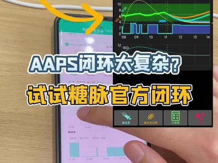 糖动闭环设置超简单#胰岛素泵#闭环设置