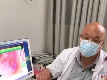 门诊故事-粘液腺囊肿#皮肤