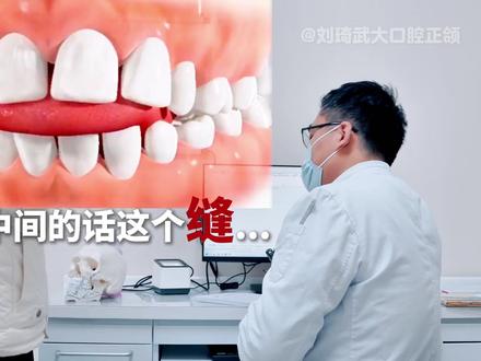 拥有新面孔,也要培养新习惯! #正颌 #开颌