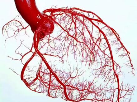 冠脉血管哪根堵了最危险?#心脏 #冠心病#心肌梗死 #医学科普