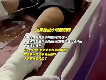 贵州网红"曾输记"在坦桑尼亚遭绑架,被折磨七天七夜后逃出,目前在同胞的帮助下正在医院接受治疗。