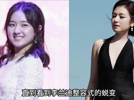 看到李兰迪的蜕变才明白,普通女孩原来也能这么美 #李兰迪 #体态 #气质美女 #杨幂 #刘诗诗
