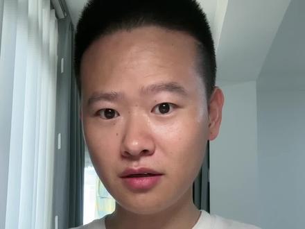 宝宝被蜜蜂蚂蜂蜇到怎么办#爱未来 #健康育儿 #蚊虫叮咬 #新生儿科张医生