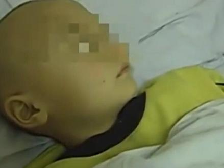 6岁男孩生殖器坏死,全是皮筋惹的祸,最终被迫手术切除 #儿童安全 #留守儿童 #校园