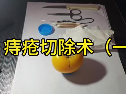 妙手回春,痔疮切除#逗大家开心一下