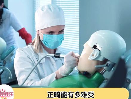 天呐,感觉已经看到了365天的溃疡。。#正畸