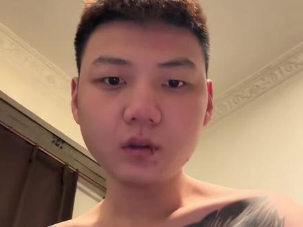 #戒断反应 兄弟们身体非常疼所以健完身就回家了 昨天那个第一天被人举报下架了