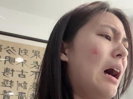 有时候一个人上网挺无助的,第一个想着用蟑螂榨汁的人,是谁啊#中药 #祛痘 #冷知识