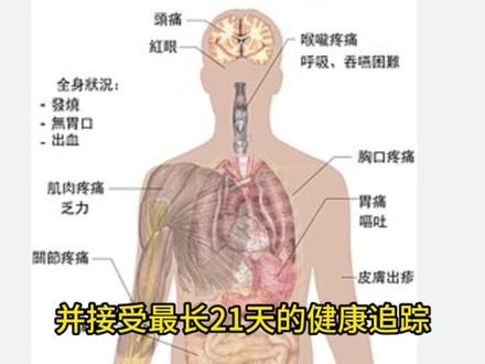 泰国严查埃博拉!盯紧两国旅客 泰国卫生部5月20日宣布,将刚果(金)和乌干达列为“危险传染病地区”,自21日起升级埃博拉防控。所有来自这两国的旅客登机前须通过泰国电子入境卡或Thai Health Pass登记信息,航空公司需提前提交旅客名单并做症状筛查。入境泰国时,旅客须接受二次测温、症状问询,并登记住址及电话,接受最长21天健康追踪。泰方建议民众如无必要暂缓前往疫情地区。卫生部门表示无需恐慌,现有体系可有效应对。埃博拉主要通过接触血液、体液传播,症状包括高烧、呕吐、异常出血
#埃博拉防控 #泰国入境新规 #公共卫生安全