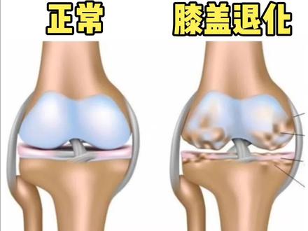 【膝盖强化】常练4个动作,保护膝关节,减少疼痛与磨损! #运动康复 #膝盖 #膝盖疼 #关节 #膝盖弹响