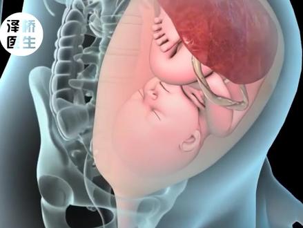 剖宫产中横切口和竖切口有什么区别?#医学科普 #科普 #胎儿 #孕育 #剖腹产 #胎儿发育