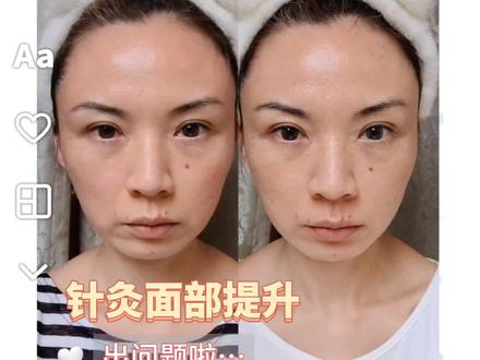 我又在拿自己做实验!#辣妈日记 #抗衰老 #护肤分享 #面部提升
