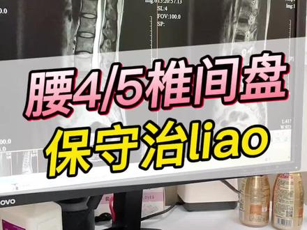 #腰椎间盘突出 腰4/5椎间盘突出,保守方法 #骨科 #郑帅医生