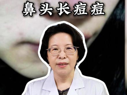 鼻头长痘痘怎么办? #医疗健康创作训练营 #抖出健康知识宝藏 #鼻头长痘 #中医健康科普 #养生