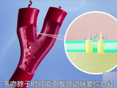 为什么有的情侣热衷于种草莓?接吻时的咬嘴唇有多迷人?#接吻 #种草莓