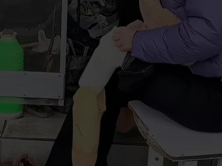外卖小姐姐假肢断裂,厂家开价一万二,结果修鞋大爷免费修好 #假肢