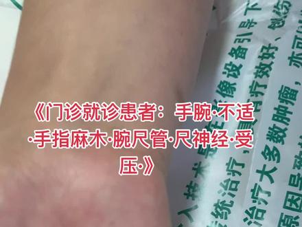 #腕尺管综合征 又称 #Guyon管 #尺神经卡压,和腕管综合征相似但不是一个部位,不是很常见,如果出现尺神经受压的症状和表现!长期麻木不适的可以松解术治疗#尺神经#尺神经炎#肘管综合征#手#麻木#手指#手指麻木#肘管#肘关节#肘管综合征#小指麻木#肘管松解术#腕管#腕管综合征#腕管松解术#微创#切口#正中神经#医生#医者仁心#手外科#武汉协和医院#武汉协和医院李涛#抖音#抖音小助手#健康#健康最重要#科普#医学#医学科普#医学知识#dou#康复#关节炎#开启健康2023