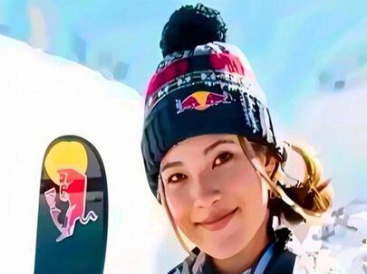 谷爱凌:从脑出血险丧命到冬奥再出征,天才的荣光全是拿命拼来#社会百态 #热门 #新闻 #每日分享