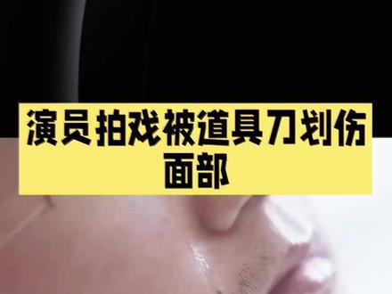 拍戏时被道具刀划伤,连夜送医缝了美容针!剧组说是木质道具,可现场看着像开刃的…你觉得这到底是意外,还是剧组安全没做到位?👇#拍戏意外 #剧组安全 #明星近况 #娱乐热点 #王弘毅
