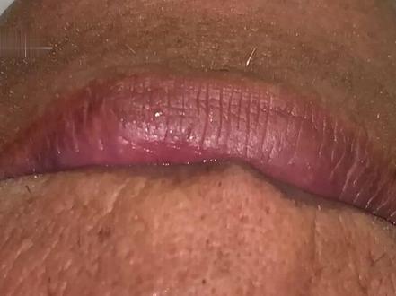 十年烟王洗牙全过程 #洗牙视频 #洗牙过程